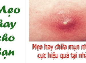 Tất tần tật cách chữa mụn nhọt nhanh nhất không đau, không để lại sẹo